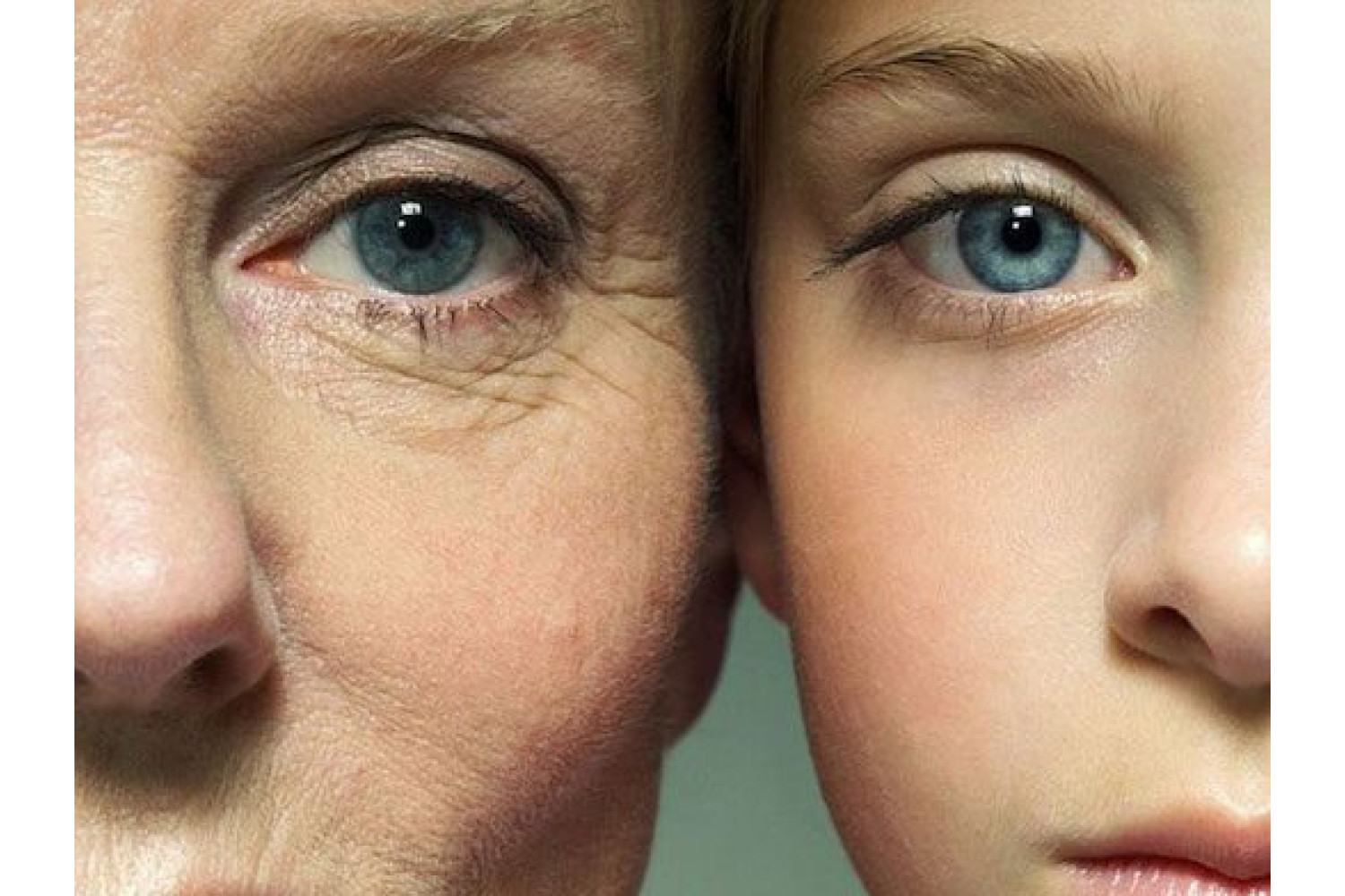 Типы старения лица: мелкоморщинистый тип